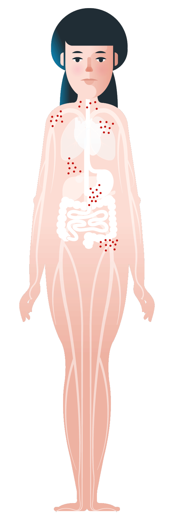 Skin symptoms of anaphylaxis