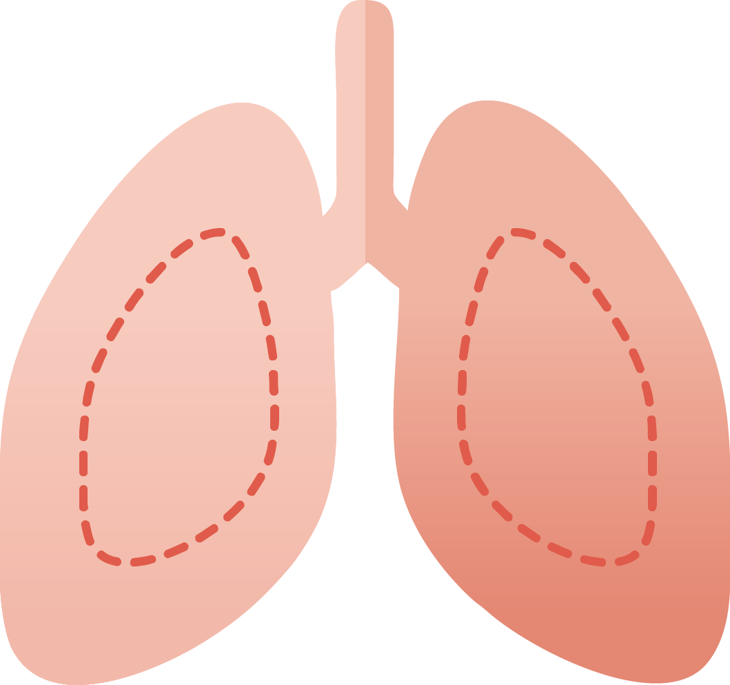 Anaphylaxis symptoms: shortness of breath