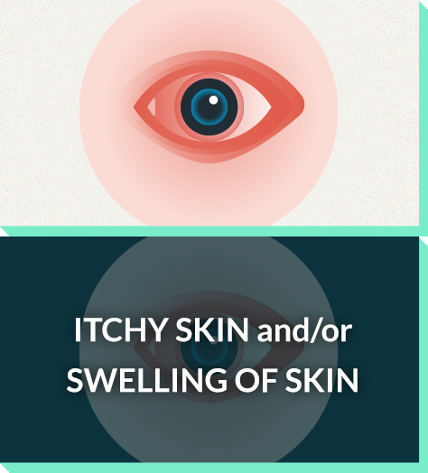 Severe allergy symptoms: itchy skin, swelling skin