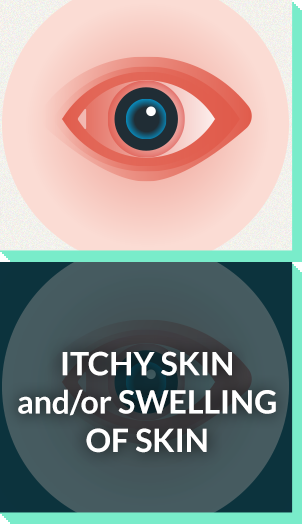 Severe allergy symptoms: itchy skin, swelling skin